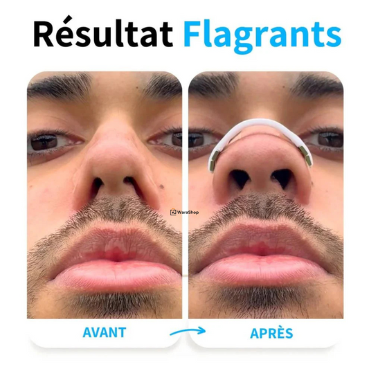 Bandelette Nasale – Améliorez votre respiration et éliminez les ronflements